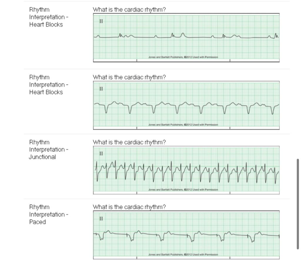 Solved What is the correct cardiac rhythm strip answers? | Chegg.com