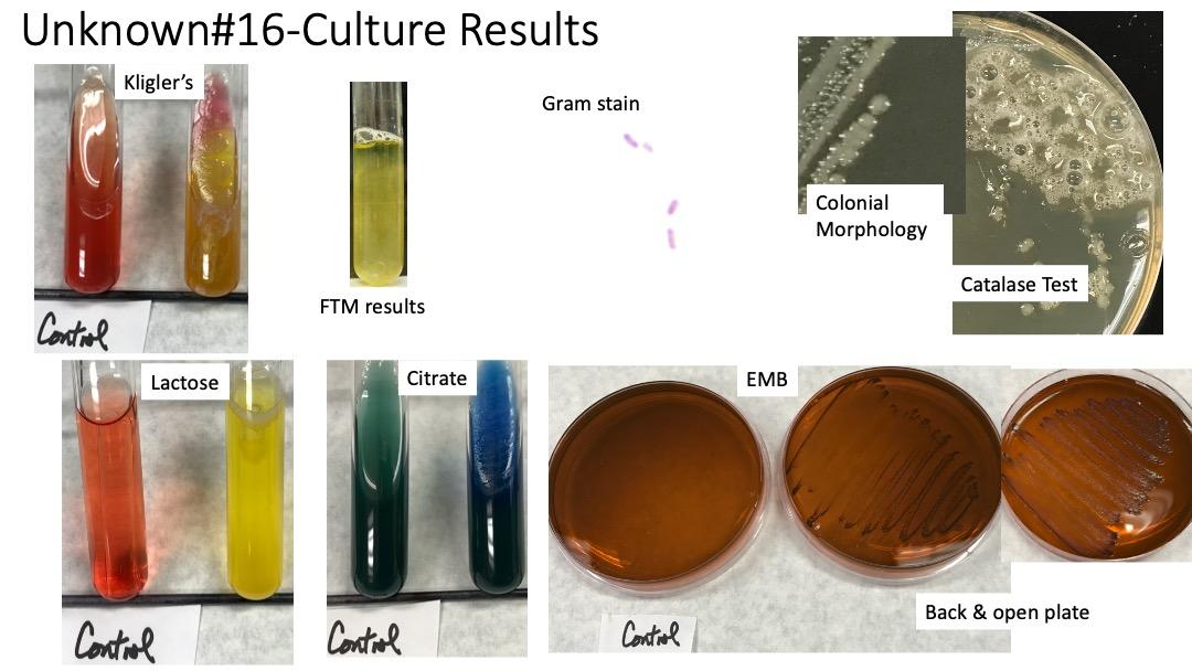 Solved Unknown#16-Culture Results Kligler's Gram stain | Chegg.com