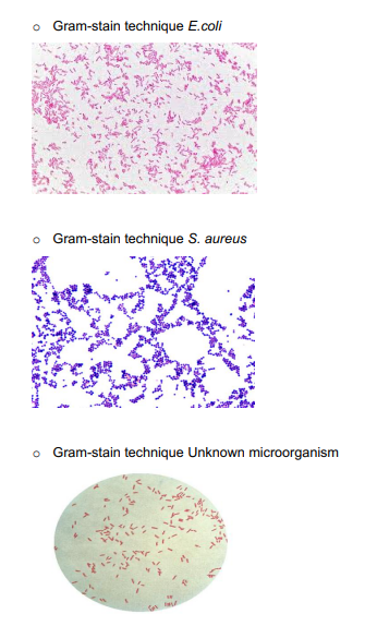 Solved For Each Image Describe The Bacteria S Color The Chegg Com