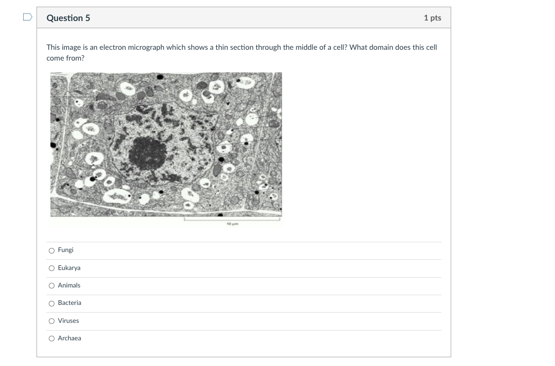 Solved Question 5 1 pts This image is an electron micrograph | Chegg.com