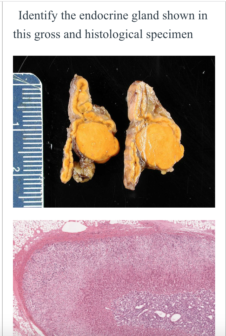 Solved Identify The Endocrine Gland Shown In This Gross And | Chegg.com