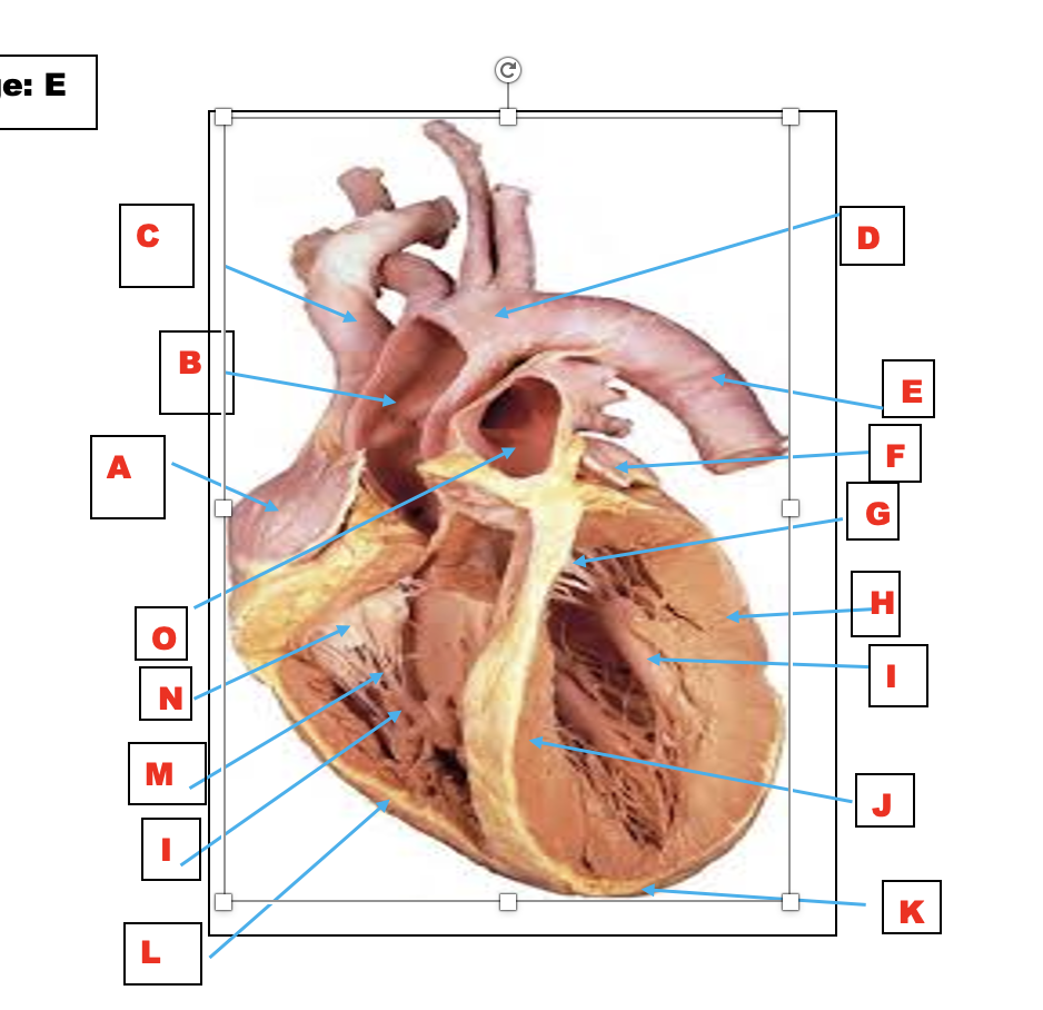 Solved What is the section and view of the heart? Name | Chegg.com