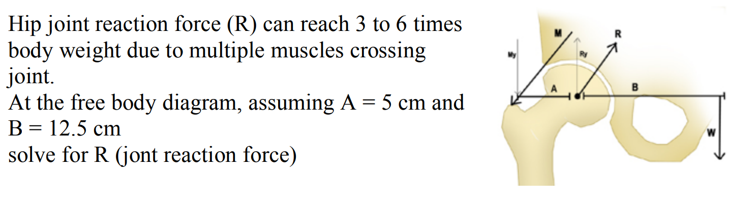 Solved Hip joint reaction force (R) ﻿can reach 3 ﻿to 6 | Chegg.com