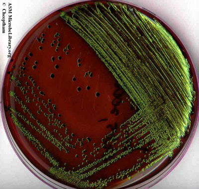 Solved The following picture shows the growth of bacteria on | Chegg.com