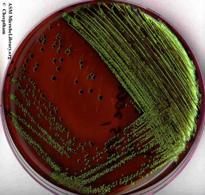 Solved The following picture shows the growth of bacteria on