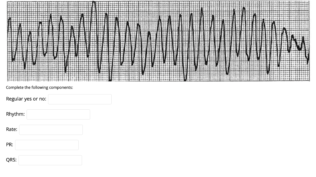 Complete the following components: Regular yes or no: Rhythm: Rate: PR: QRS: