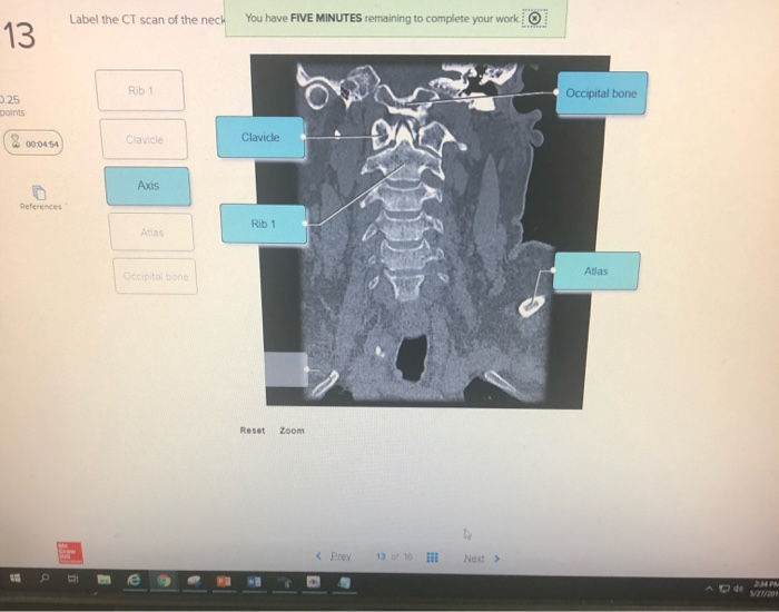 30 Label The Ct Scan Of The Neck Labels Design Ideas 2020