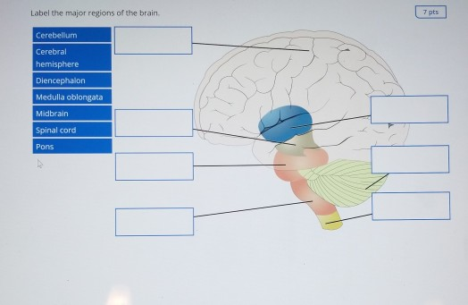 regions of the brain