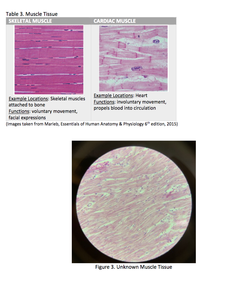 skeletal muscle example