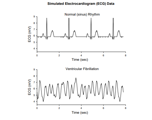 Solved - IN MATLAB create the following graph of the normal | Chegg.com