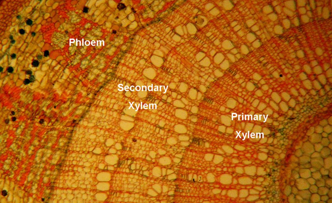 Phloem Secondary Xylem Primary Xylem Xylem Phloem