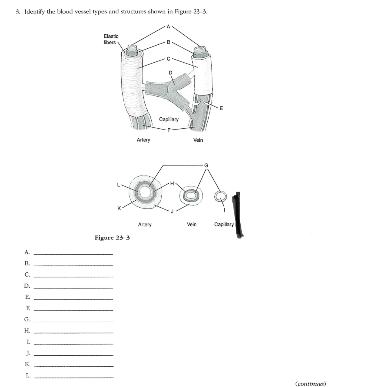 Solved 1. Identify the parts of the capillary bed shown in