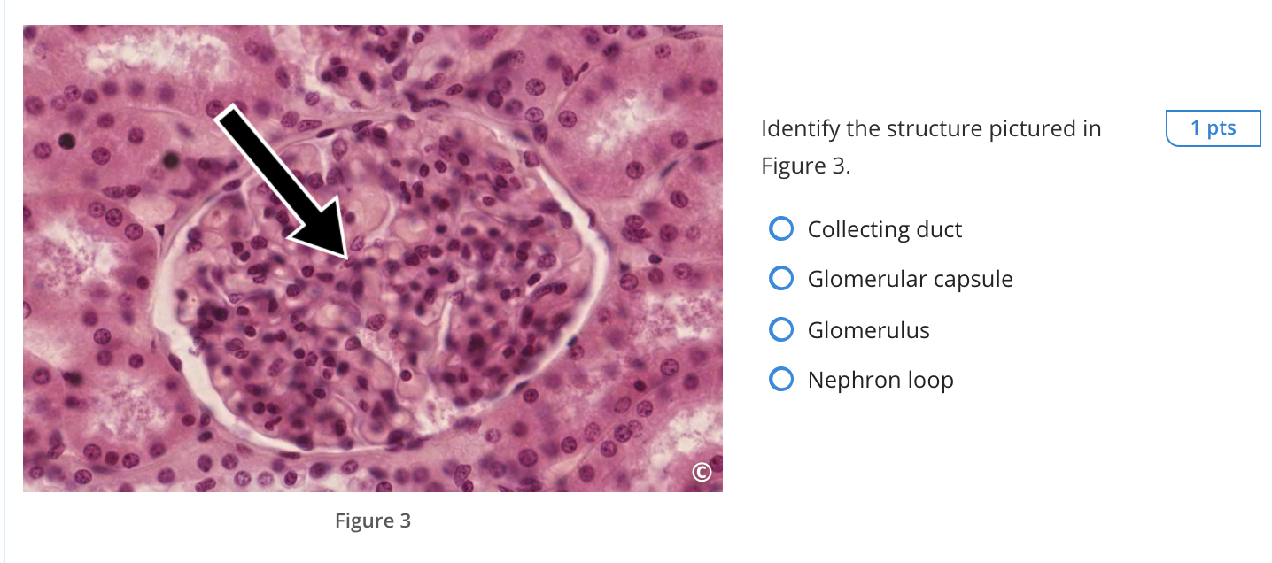 Solved 1 pts Which portion of the kidney is pictured in | Chegg.com, image size:1436x636