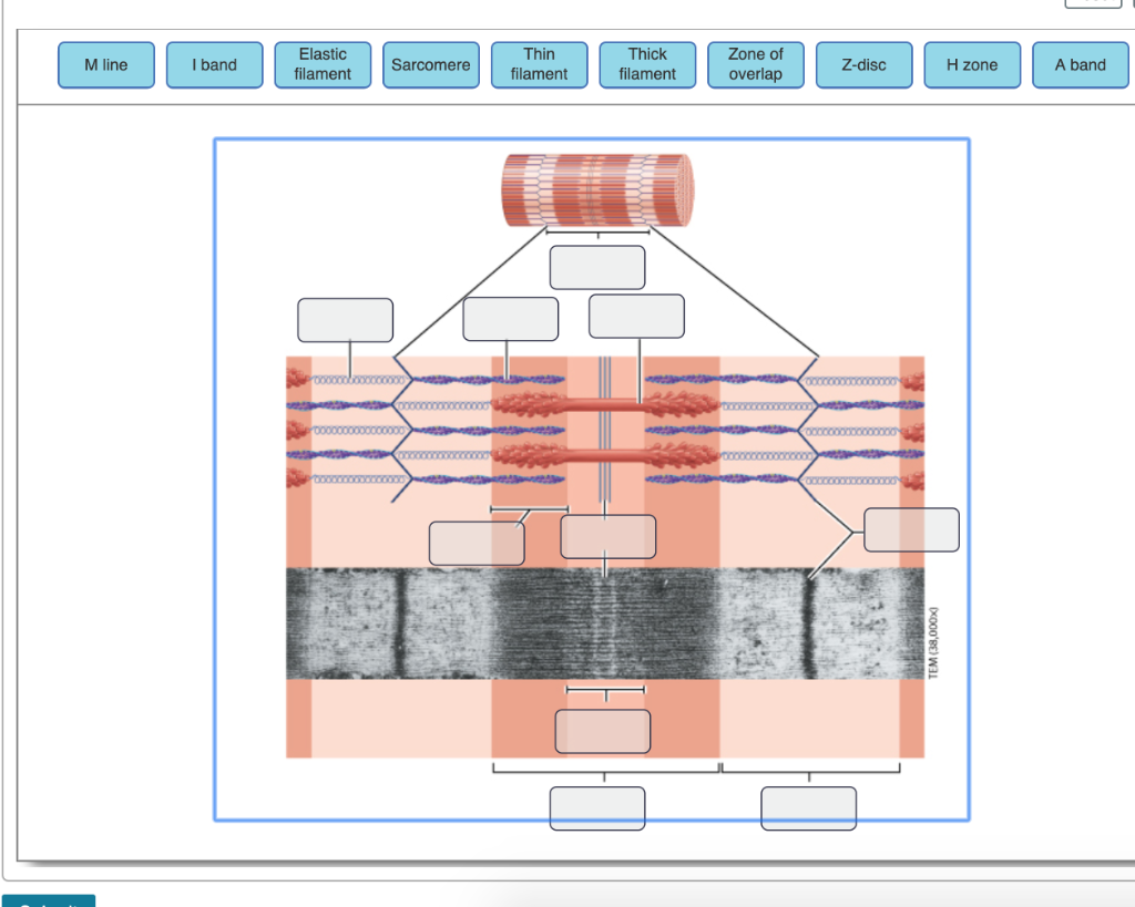 solved-elastic-filament-thin-filament-thick-filament-zone-of-chegg