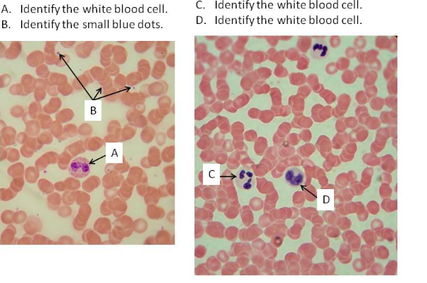 solved-a-identify-the-white-blood-cell-c-identify-the-chegg