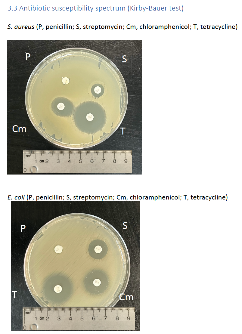 Empiric - antibiotic card game on X: When you hear the e coli is pan  susceptible  / X