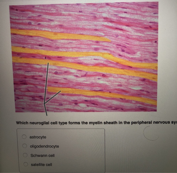 Solved Which neuroglial cell type forms the myelin sheath in | Chegg.com
