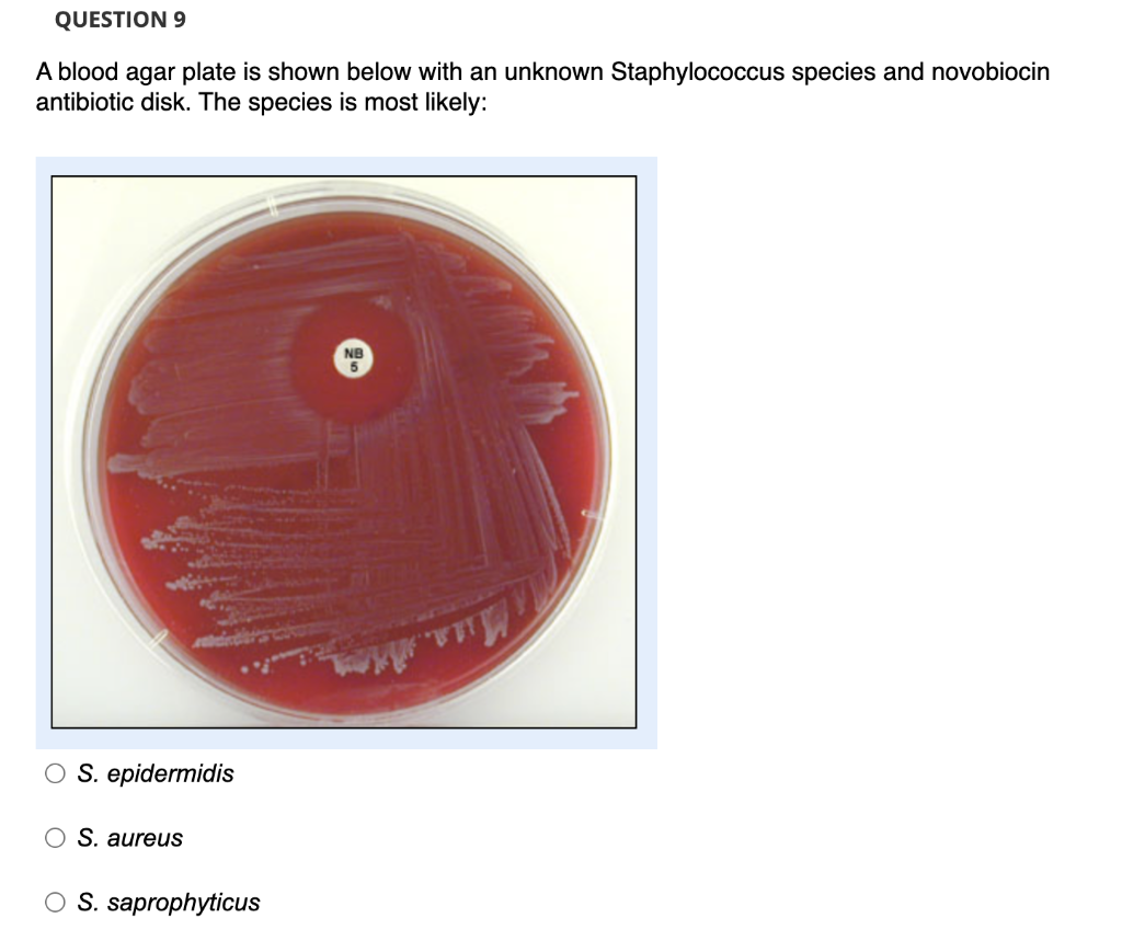 Solved QUESTION 7 A mannitol salt agar plate is shown below | Chegg.com