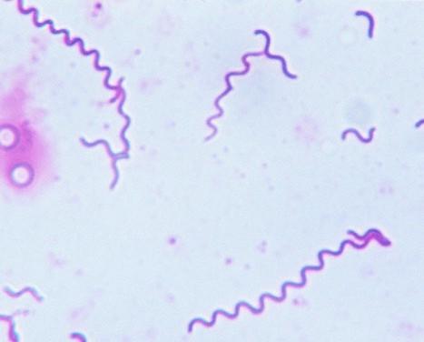 spirochetes gram stain