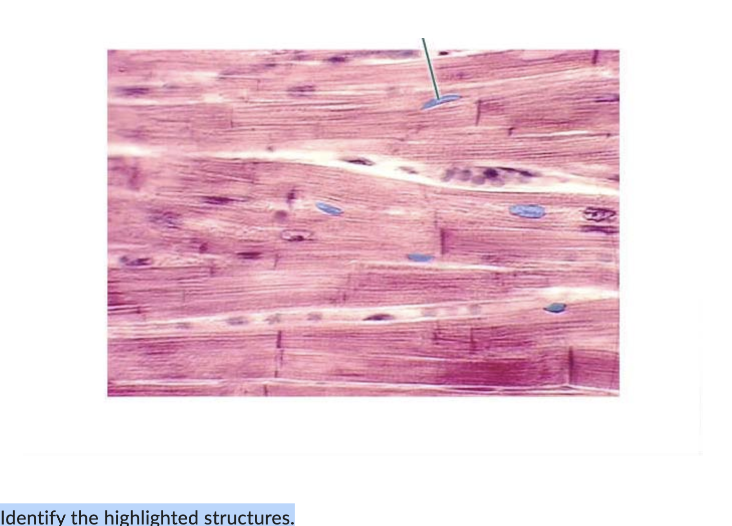 Solved Identify the highlighted structures. | Chegg.com