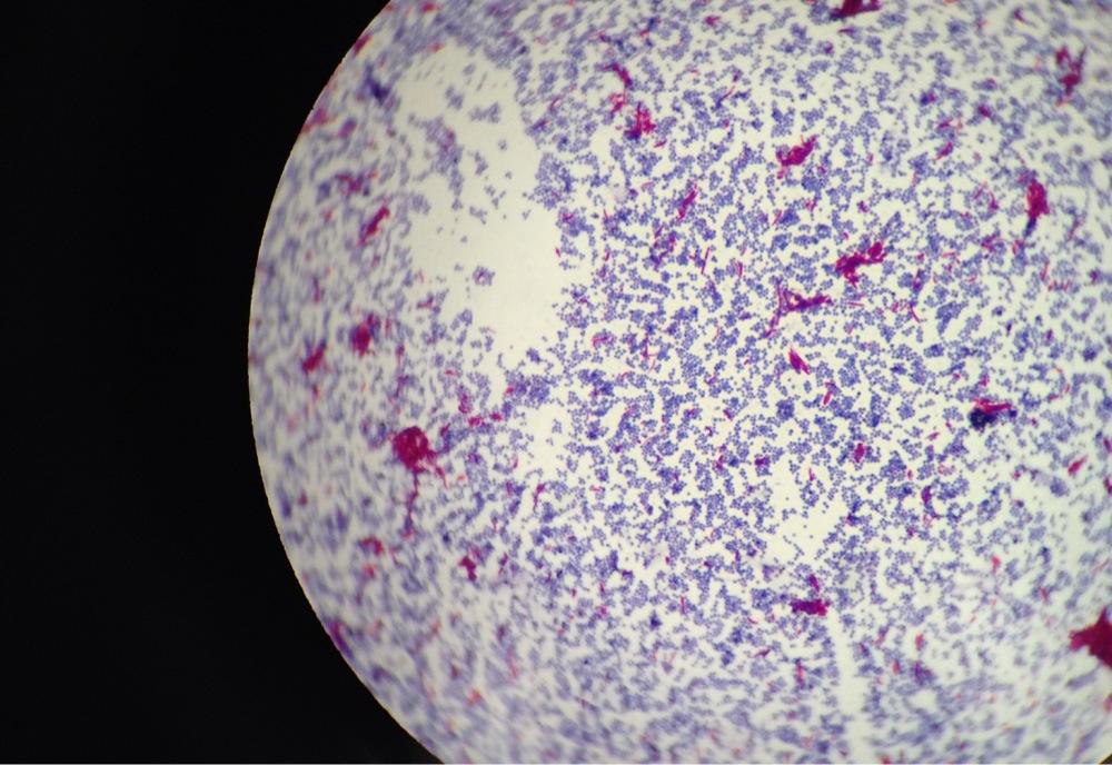 micrococcus luteus acid fast stain