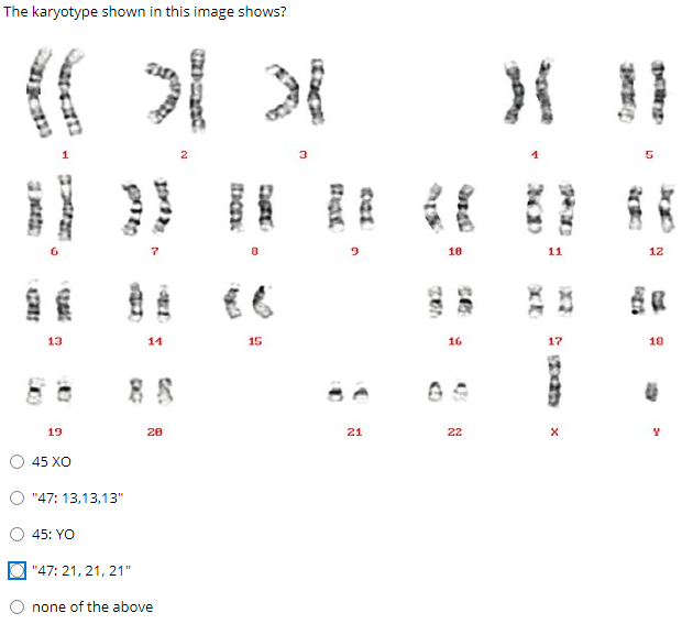 Solved The karyotype shown in this image shows? 2 LD De 1200 | Chegg.com