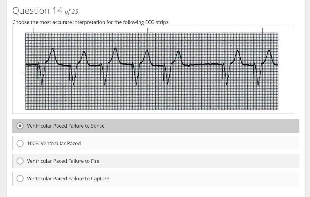 Choose the most accurate interpretation for the following ECG stribs:
Ventricular Paced Failure to Sense
100\% Ventricular Pa