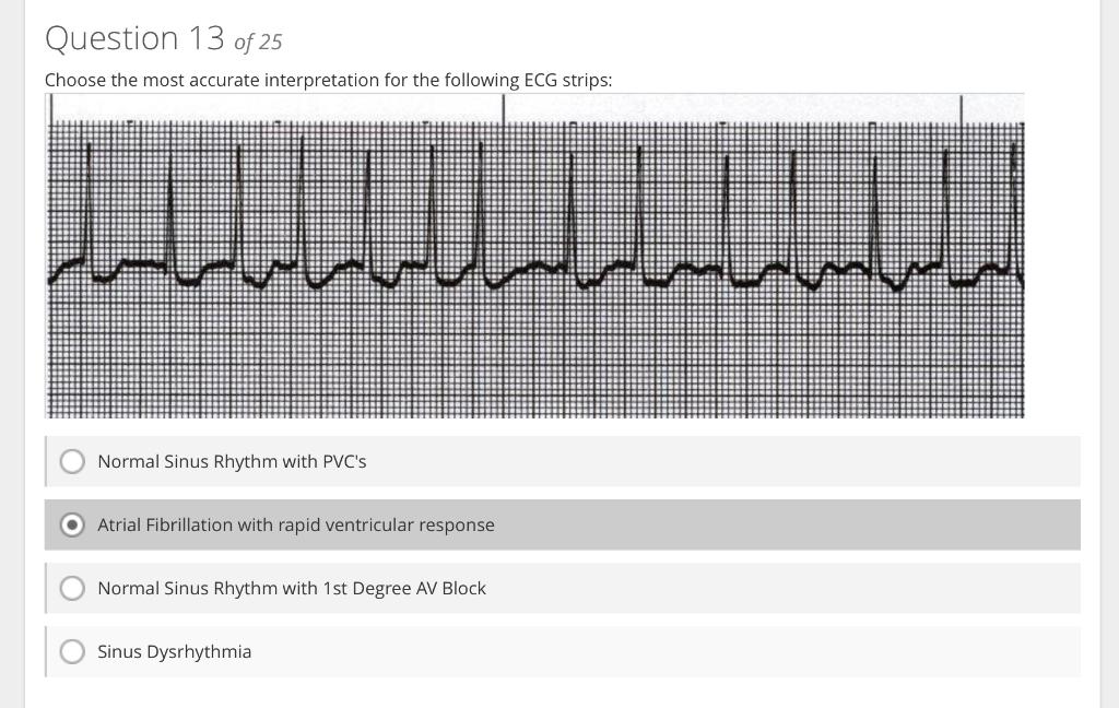 Normal Sinus Rhythm with PVCs
Atrial Fibrillation with rapid ventricular response
Normal Sinus Rhythm with 1st Degree AV Blo