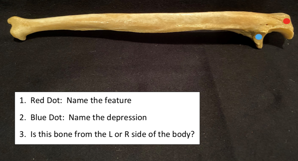 joint of the bones help in the dot dot of the body
