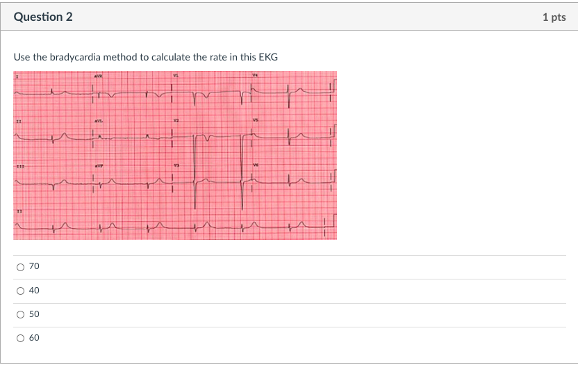 Question 1 1 Pts Use The 300 150 Method To Calculate Chegg Com