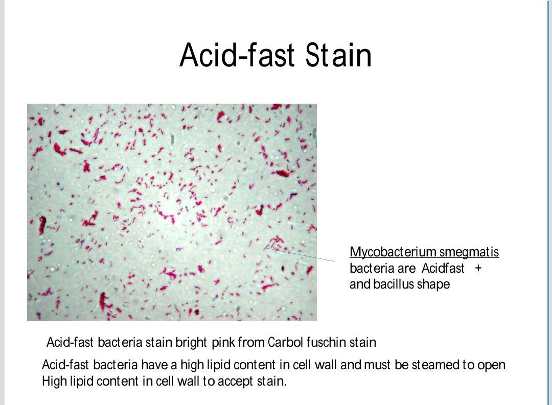 bacillus megaterium acid fast stain