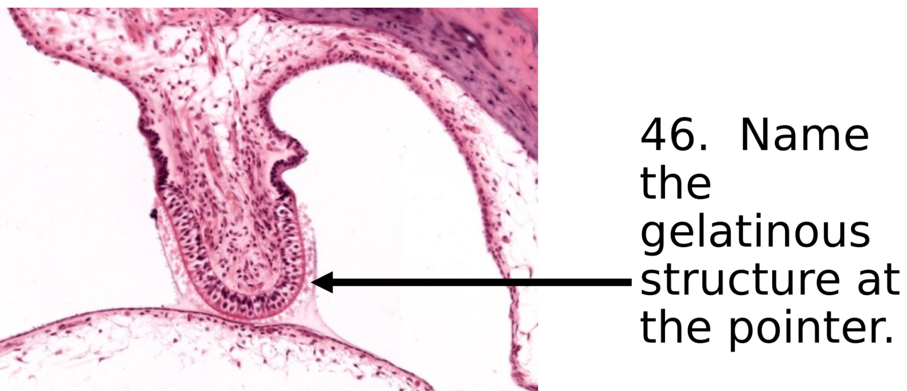 Solved 46. Name the gelatinous structure at the pointer.