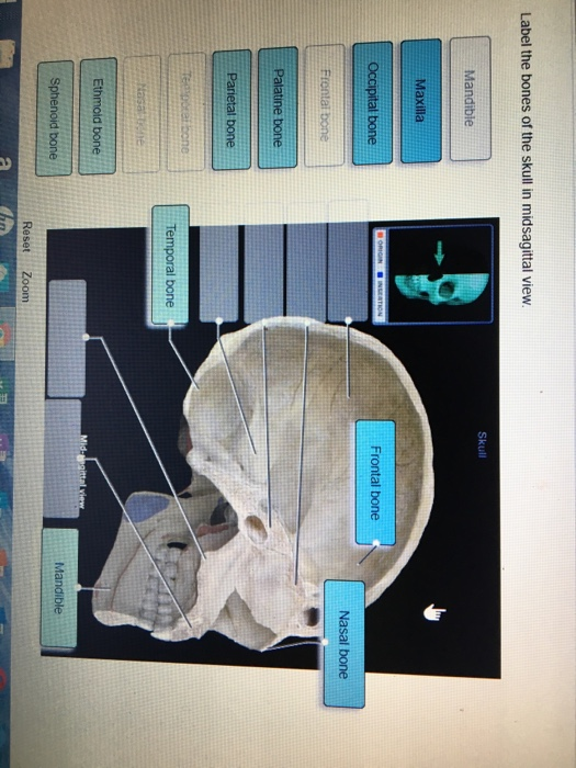 Solved: Label The Bones Of The Skull In Midsagittal View M... | Chegg.com