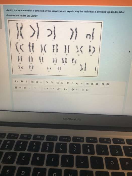 Solved Examine the following pedigree chart of color