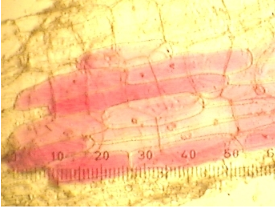 Solved a) What is the size of this onion cell's nucleus?