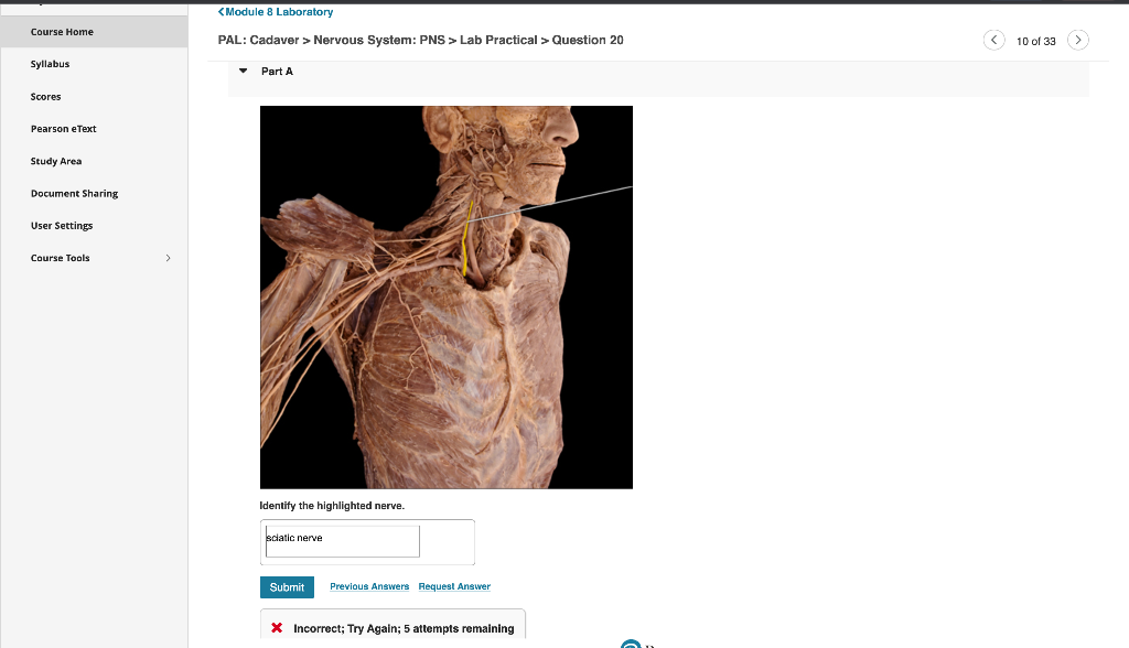 Solved PAL: Cadaver > Nervous System: PNS > Lab Practical > | Chegg.com