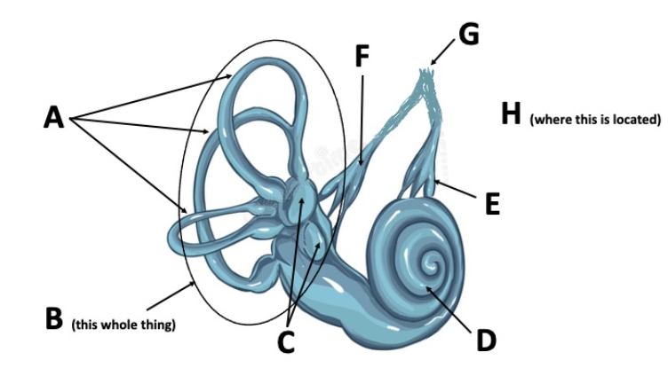 Solved Label the organs for vestibular and auditory | Chegg.com