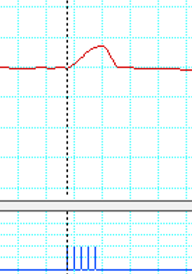 Solved Label The Contraction Phase As "A," The Latent Period | Chegg.com