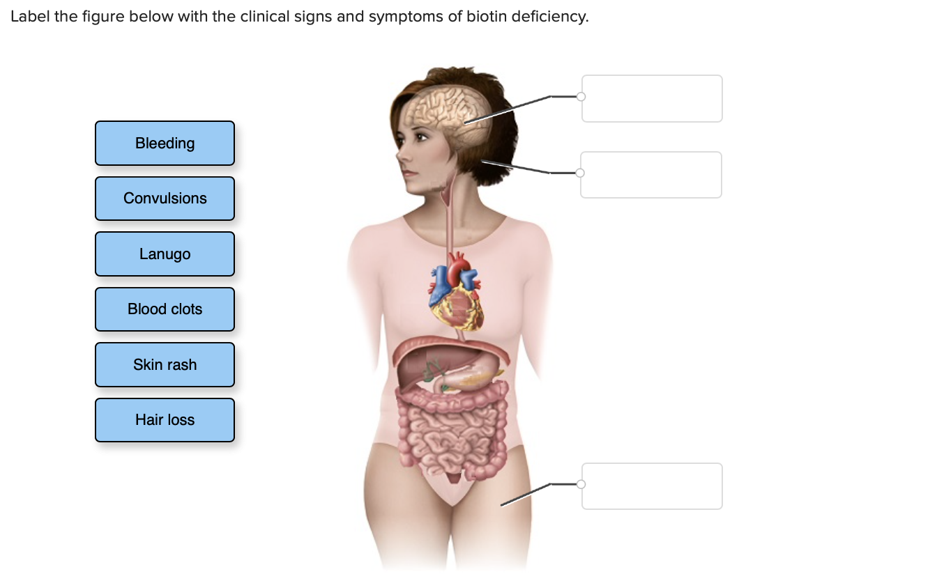 Solved Label the figure below with the clinical signs and
