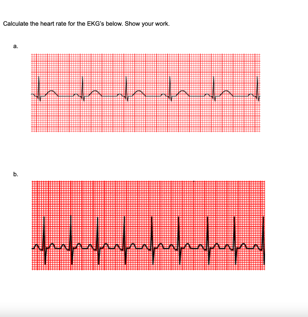 Solved Calculate the heart rate for the EKG's below. Show | Chegg.com