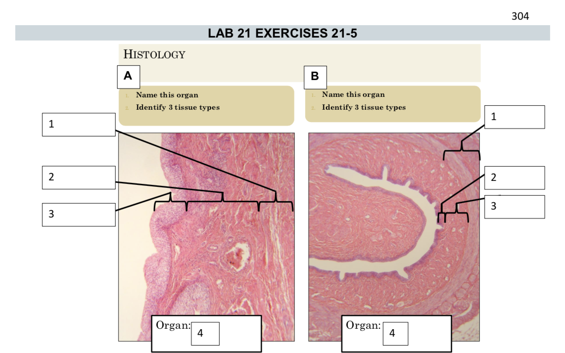 Solved 304 LAB 21 EXERCISES 215 HISTOLOGY 1. Name this