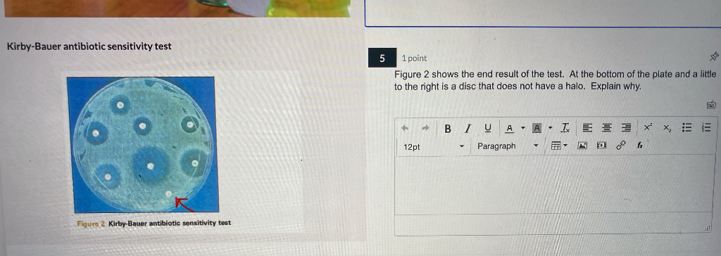 Solved Kirby-Bauer Antibiotic Sensitivity Test 5 1 Point | Chegg.com