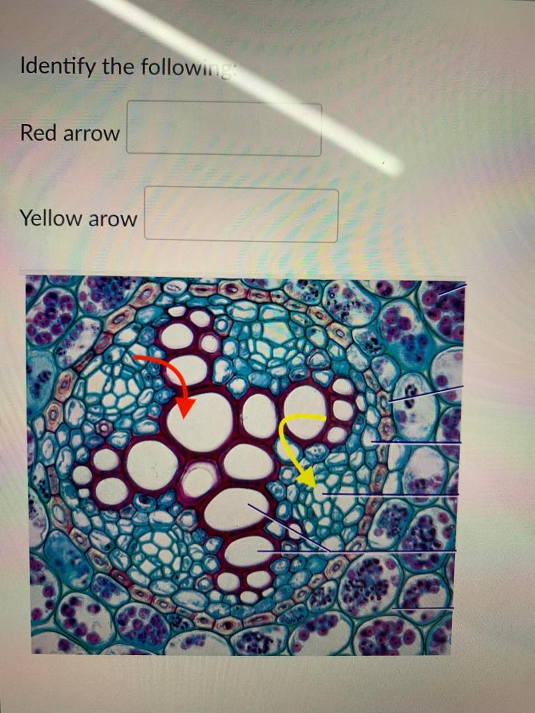 Solved Identify the following: Red arrow Yellow arow | Chegg.com