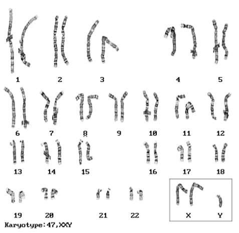 Solved Here is a metaphase karyotype for Joey. Joey has | Chegg.com