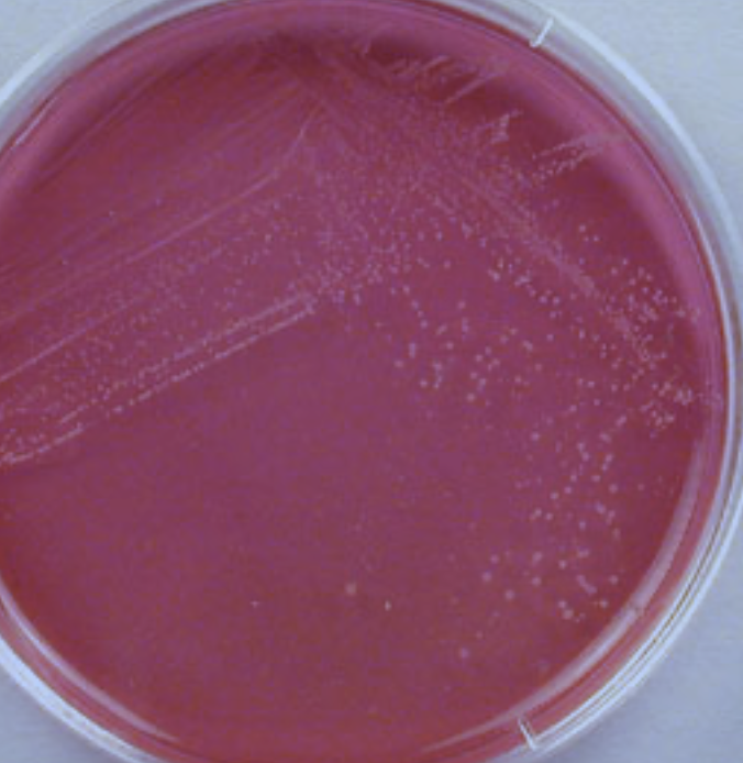 Solved Based on my results, if Staphylococcus aureus turns | Chegg.com