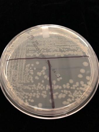 e coli streak plate