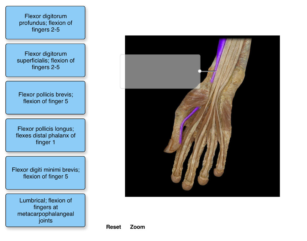 Solved Flexor digitorum profundus; flexion of fingers 2-5 | Chegg.com