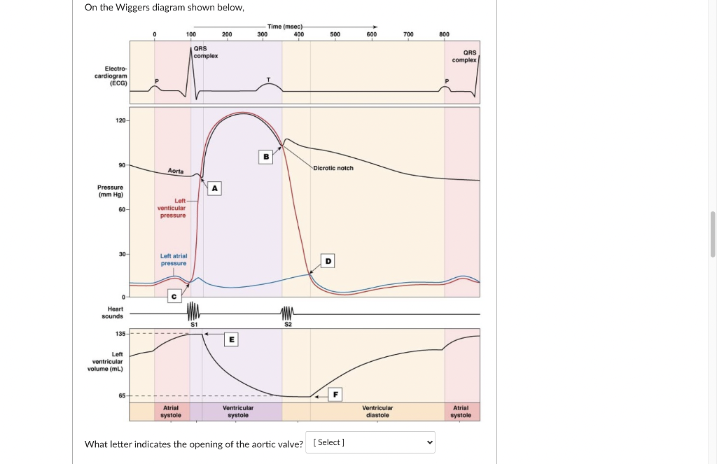 Solved On the Wiggers diagram shown below, Time (msec) 300 | Chegg.com