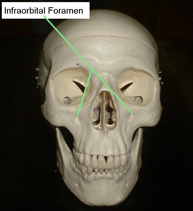 infraorbital foramen landmark