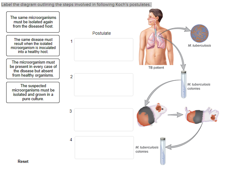 mycobacterium tuberculosis labelled diagram